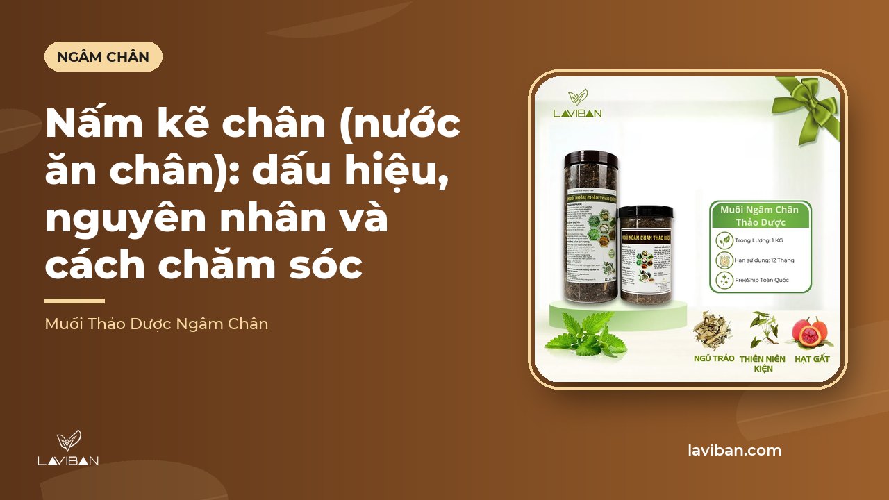 Nấm kẽ chân (nước ăn chân): dấu hiệu, nguyên nhân và cách chăm sóc